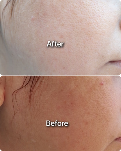 ACTEEN OIL FREE FACE WASH 50% OFF
